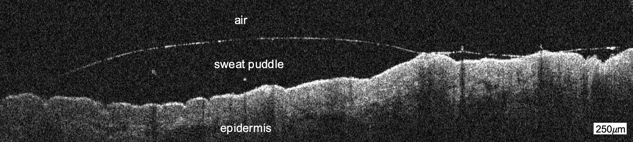 A micro-to-macroscale and multi-method investigation of human sweating dynamics
